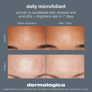 Dermalogica Daily Microfoliant Refill Pack 74g